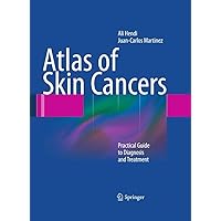 Atlas of Skin Cancers: Practical Guide to Diagnosis and Treatment Atlas of Skin Cancers: Practical Guide to Diagnosis and Treatment Kindle Hardcover Paperback