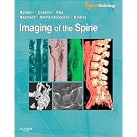 Imaging of the Spine: Expert Radiology Series Imaging of the Spine: Expert Radiology Series Kindle Hardcover