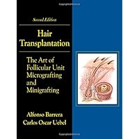 Hair Transplantation: The Art of Micrografting and Minigrafting, Second Edition Hair Transplantation: The Art of Micrografting and Minigrafting, Second Edition Hardcover