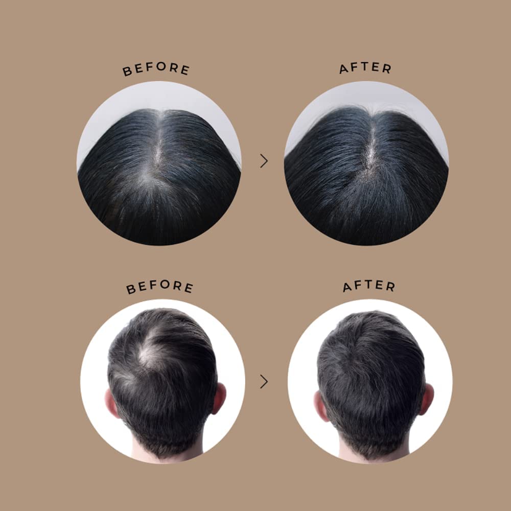 Mua Vita Hair Growth & Hair Loss 100% Natural Herbs Potent Formula for Greying  Thinning Hair Stimulate New Hair Follicles Supplement for Men/Women- 90  Capsules trên Amazon Mỹ chính hãng 2023 | Giaonhan247