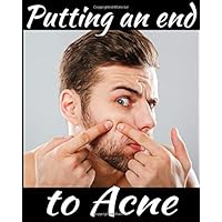 Putting an end to acne: Monitor your acne day after day, with follow-ups on symptoms, diet, treatments, pain intensity, etc... 8X10, 101 pages