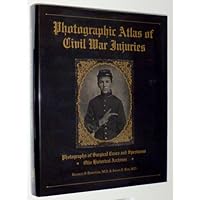 Photographic Atlas of Civil War Injuries: Photographs of Surgical Cases and Specimens, Otis Historical Archives Photographic Atlas of Civil War Injuries: Photographs of Surgical Cases and Specimens, Otis Historical Archives Hardcover