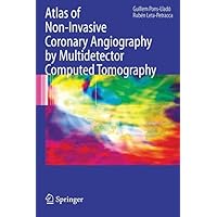 Atlas of Non-Invasive Coronary Angiography by Multidetector Computed Tomography (Developments in Cardiovascular Medicine Book 259) Atlas of Non-Invasive Coronary Angiography by Multidetector Computed Tomography (Developments in Cardiovascular Medicine Book 259) Kindle Hardcover Paperback