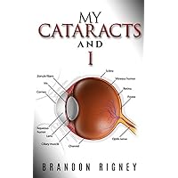 My Cataracts and I: Experiences With Cataract Removal From My Eyes, As Complicated By Glaucoma My Cataracts and I: Experiences With Cataract Removal From My Eyes, As Complicated By Glaucoma Kindle
