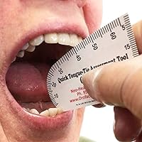 Quick Tongue-Tie Assessment (50)