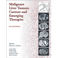 Malignant Liver Tumors: Current And Emerging Therapies Malignant Liver Tumors: Current And Emerging Therapies Hardcover