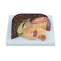 Human Pancreas, Liver, Duodenum, Gallstones, Spleen, Liver and Gallbladder Anatomical Model, Used for Medical Teaching, 9.8х7х2.5in