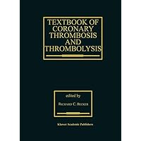 Textbook of Coronary Thrombosis and Thrombolysis (Developments in Cardiovascular Medicine, 193) Textbook of Coronary Thrombosis and Thrombolysis (Developments in Cardiovascular Medicine, 193) Hardcover Kindle Paperback