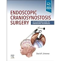Endoscopic Craniosynostosis Surgery: An Illustrated Guide to Endoscopic Techniques Endoscopic Craniosynostosis Surgery: An Illustrated Guide to Endoscopic Techniques Hardcover Kindle