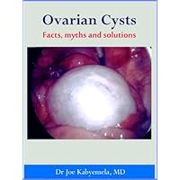 Ovarian Cysts A-Z: Facts, myths and solutions Ovarian Cysts A-Z: Facts, myths and solutions Kindle