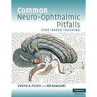 Common Neuro-Ophthalmic Pitfalls: Case-Based Teaching (Cambridge Medicine (Paperback)) Common Neuro-Ophthalmic Pitfalls: Case-Based Teaching (Cambridge Medicine (Paperback)) Kindle Paperback Printed Access Code