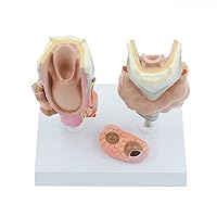 EXEMPLAR Thyroid Pathology Model Larynx Anatomical Model Teaching Medical Simulation Teaching Aid, Accurate Structure PVC Material