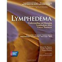 Lymphedema: Understanding and Managing Lymphedema After Cancer Treatment Lymphedema: Understanding and Managing Lymphedema After Cancer Treatment Paperback