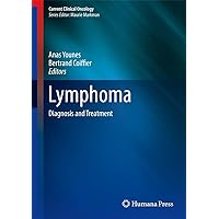 Lymphoma: Diagnosis and Treatment (Current Clinical Oncology, 43) Lymphoma: Diagnosis and Treatment (Current Clinical Oncology, 43) Hardcover Kindle Paperback