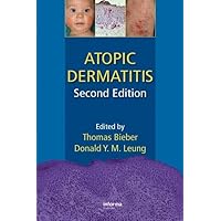Atopic Dermatitis Atopic Dermatitis Hardcover Paperback