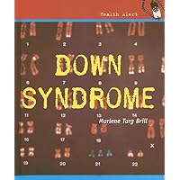 Down Syndrome (Health Aleart) Down Syndrome (Health Aleart) Library Binding