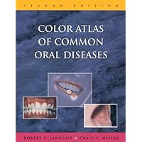 Color Atlas of Common Oral Diseases Color Atlas of Common Oral Diseases Hardcover Paperback