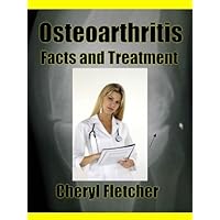 Osteoarthritis Facts and Treatments Osteoarthritis Facts and Treatments Kindle