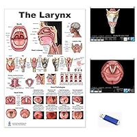Blue Tree Publishing Larynx LP Poster, voice, education, vocal folds, mouth, head cutview, vocal pathology, size 24Wx36T