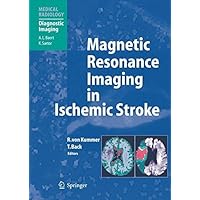 Magnetic Resonance Imaging in Ischemic Stroke (Medical Radiology) Magnetic Resonance Imaging in Ischemic Stroke (Medical Radiology) Kindle Hardcover Paperback Mass Market Paperback