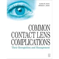 Common Contact Lens Complications: Their Recognition and Management Common Contact Lens Complications: Their Recognition and Management Paperback Mass Market Paperback