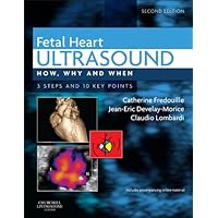 Fetal Heart Ultrasound - E-Book (How, Why and When) Fetal Heart Ultrasound - E-Book (How, Why and When) Kindle Hardcover
