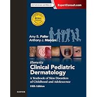 Hurwitz Clinical Pediatric Dermatology: A Textbook of Skin Disorders of Childhood and Adolescence Hurwitz Clinical Pediatric Dermatology: A Textbook of Skin Disorders of Childhood and Adolescence Hardcover
