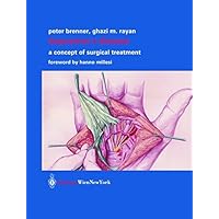 Dupuytren’s Disease: A Concept of Surgical Treatment Dupuytren’s Disease: A Concept of Surgical Treatment Kindle Hardcover