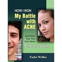 How I Won My Battle With Acne and How You Too Can Have Clear Skin