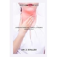 TONSIL STONES: UNDERSTANDING TONSIL STONES PERFECTLY