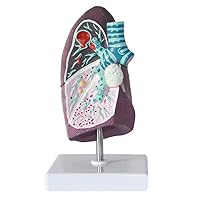 Teaching Model,Lung Cancer Model 2:3 Human Lung Anatomy Model wirh Pathological Features & Clear Texture & Accurate Anatomy Structure for Medical School Study and Research