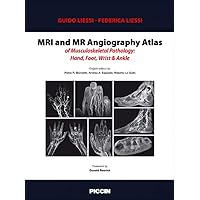 MRI and MR Angiography Atlas of Musculoskeletal Pathology: Hand, Foot, Wrist & Ankle MRI and MR Angiography Atlas of Musculoskeletal Pathology: Hand, Foot, Wrist & Ankle Kindle Hardcover