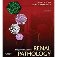 Diagnostic Atlas of Renal Pathology: Expert Consult - Online and Print Diagnostic Atlas of Renal Pathology: Expert Consult - Online and Print Kindle Hardcover
