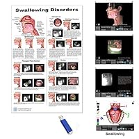Swallowing Disorders Poster 24x36 Swallowing Software, Speech Language Pathology Chart for Swallowing and Many Swallowing Disorders Types, SLP