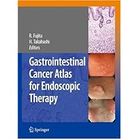 Gastrointestinal Cancer Atlas for Endoscopic Therapy Gastrointestinal Cancer Atlas for Endoscopic Therapy Kindle Hardcover Paperback