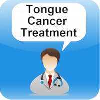 Tongue Cancer Treatment
