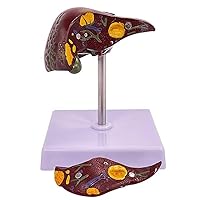 Teaching Model,Liver Cirrhosis Model Life Size Pathological Liver Anatomy Model with Clear Texture and Pathological Features and 2 Detachable Parts for Teaching Models Doctor-patie