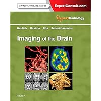 Imaging of the Brain: Expert Radiology Series Imaging of the Brain: Expert Radiology Series Hardcover