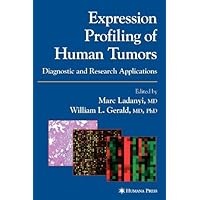 Expression Profiling of Human Tumors: Diagnostic and Research Applications Expression Profiling of Human Tumors: Diagnostic and Research Applications Kindle Hardcover Paperback