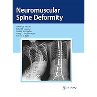Neuromuscular Spine Deformity Neuromuscular Spine Deformity Kindle Hardcover