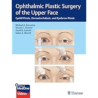 Ophthalmic Plastic Surgery of the Upper Face: Eyelid Ptosis, Dermatochalasis, and Eyebrow Ptosis Ophthalmic Plastic Surgery of the Upper Face: Eyelid Ptosis, Dermatochalasis, and Eyebrow Ptosis Kindle Hardcover
