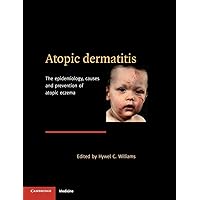 Atopic Dermatitis: The Epidemiology, Causes and Prevention of Atopic Eczema Atopic Dermatitis: The Epidemiology, Causes and Prevention of Atopic Eczema Hardcover