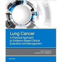 Lung Cancer: A Practical Approach to Evidence-Based Clinical Evaluation and Management Lung Cancer: A Practical Approach to Evidence-Based Clinical Evaluation and Management Paperback Kindle
