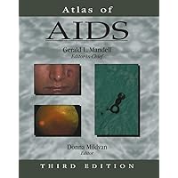 Atlas of AIDS (Atlas of Infectious Diseases (Mandell)) Atlas of AIDS (Atlas of Infectious Diseases (Mandell)) Hardcover