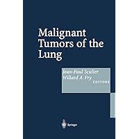 Malignant Tumors of the Lung: Evidence-based Management Malignant Tumors of the Lung: Evidence-based Management Hardcover Paperback