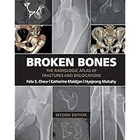 Broken Bones: The Radiologic Atlas of Fractures and Dislocations Broken Bones: The Radiologic Atlas of Fractures and Dislocations Kindle Paperback