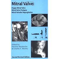 Mitral Valve: Floppy Mitral Valve, Mitral Valve Prolapse, Mitral Valvular Regurgitation