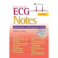 ECG Notes: Interpretation and Management Guide ECG Notes: Interpretation and Management Guide Spiral-bound Kindle