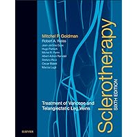 Sclerotherapy E-Book: Treatment of Varicose and Telangiectatic Leg Veins (Expert Consult) Sclerotherapy E-Book: Treatment of Varicose and Telangiectatic Leg Veins (Expert Consult) eTextbook Hardcover