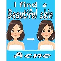 I find a beautiful skin acne: Monitor your acne day after day, with follow-ups on symptoms, diet, treatments, pain intensity, etc... 8X10, 101 pages